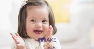 عدد كروموسومات شخص مصاب بمتلازمة داون